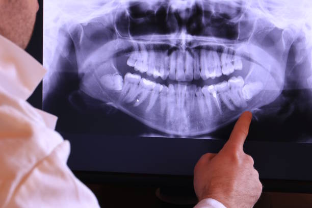 Best Emergency Dental Care for Broken or Chipped Teeth in Lathrop, MO