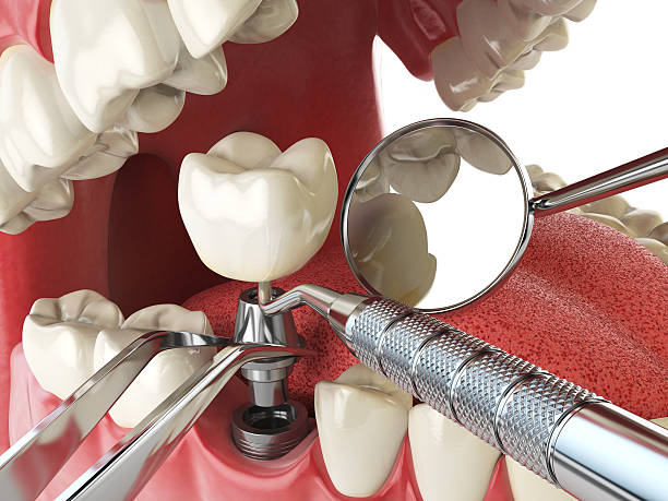 Best Pediatric Emergency Dentist in Lathrop, MO